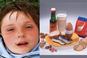 Obat Alergi pada Anak